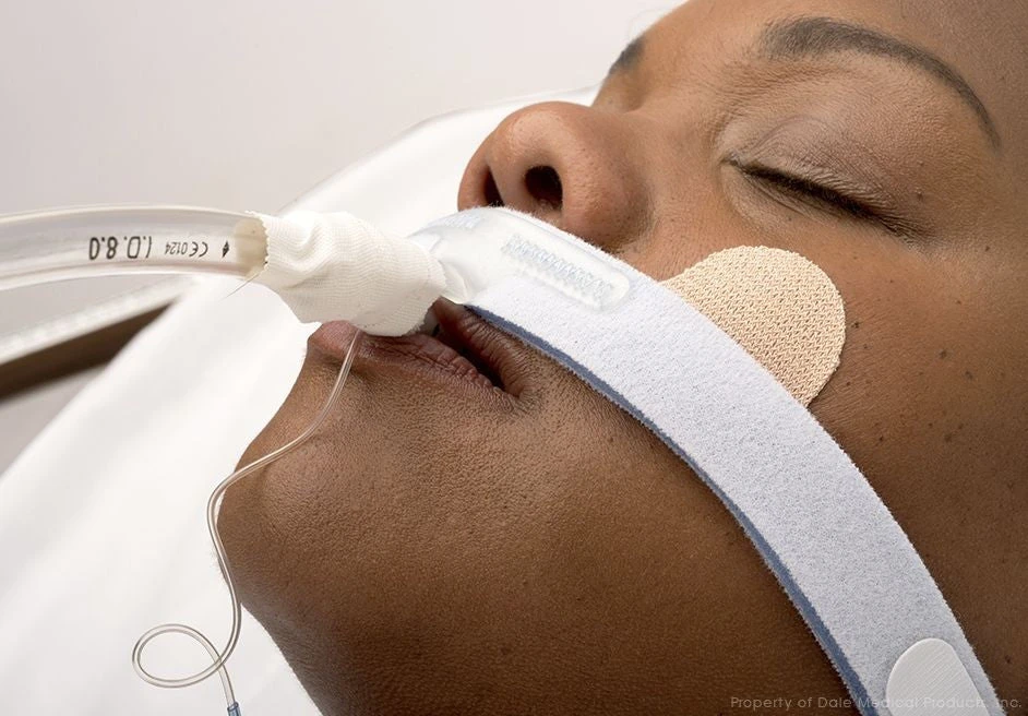 2026-03-03-69a6e320d6ec2.webp Dale Stabilock Endotracheal Neck Band Adults Box of 10 - Image 1